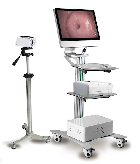 Digital Optical Colposcope